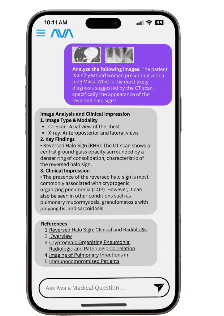 Ava app interface